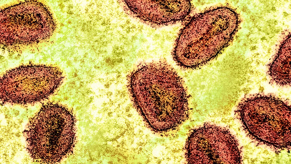 Mpox chinois Congo CDC